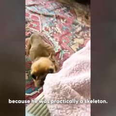The Shocking Surgery Discovery That Finally Let Emmett Breathe